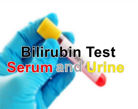 bilirubina 1 in urina|Bilirubin in Urine